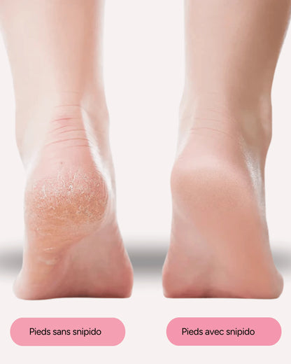 Snipido Glow Pro 3| Anti-callosités