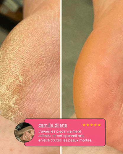 Snipido Glow Pro 3| Anti-callosités